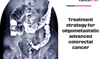 Treatment strategy for oligometastatic advanced colorectal cancer