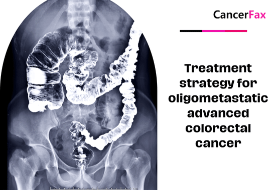 Treatment strategy for oligometastatic advanced colorectal cancer