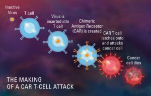 CAR T Cell therapy for T Cell acute lymphoblastic leukemia