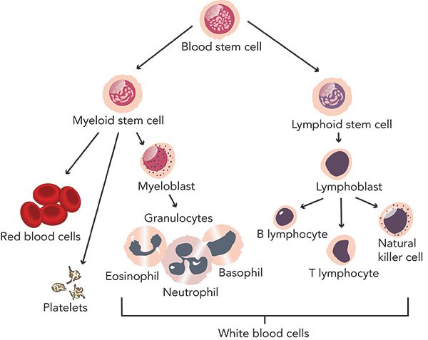 Acute lymphocytic leukemia treatment diagnosis - CancerFax
