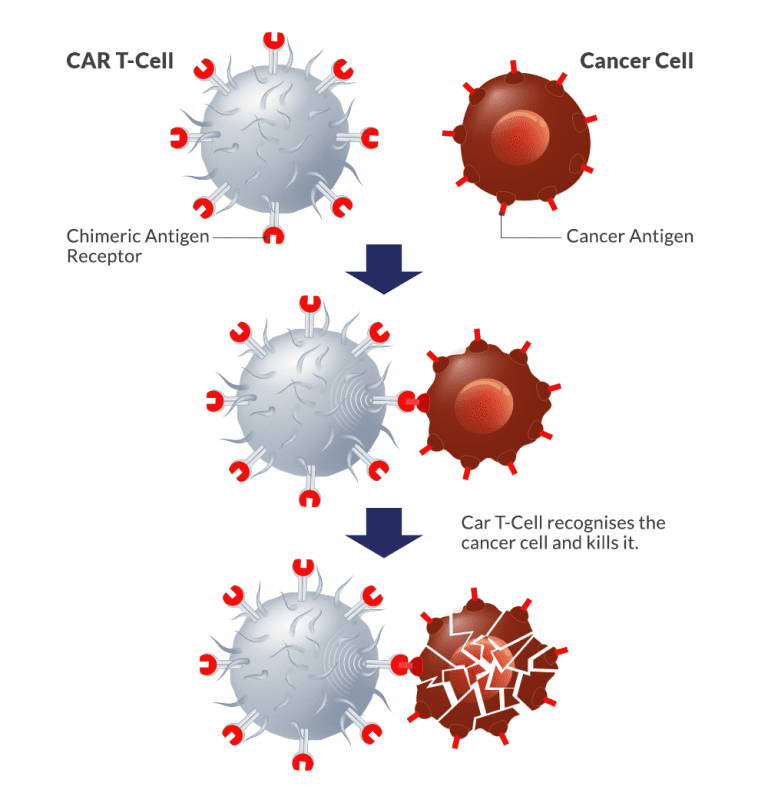 How CAR T Cell therapy works in Singapore