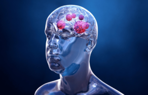 Glioblastoma CAR T Cell therapy clinical trials