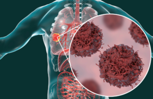 New-drugs-in-advanced-cancer-treatment