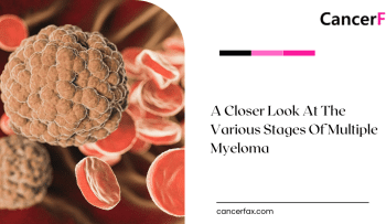 A Closer Look At The Various Stages Of Multiple Myeloma