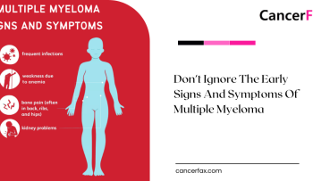 early signs and symptoms of multiple myeloma