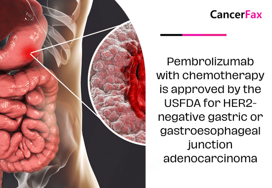 Pembrolizumab with chemotherapy is approved by the USFDA for HER2-negative gastric or gastroesophageal junction adenocarcinoma
