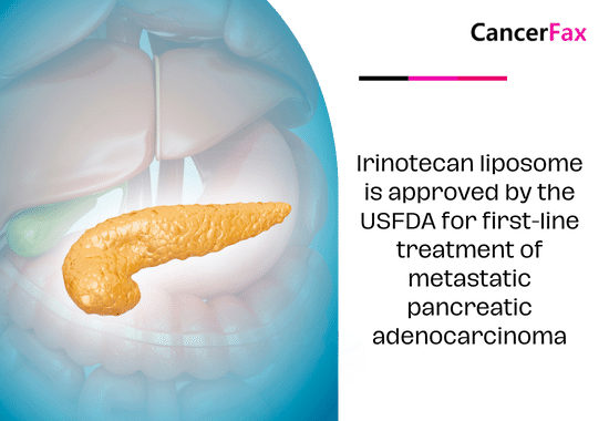 Irinotecan liposome is approved by the USFDA for first-line treatment of metastatic pancreatic adenocarcinoma