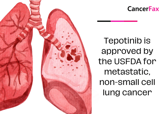 Tepotinib is approved by the USFDA for metastatic, non-small cell lung cancer