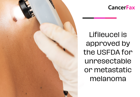Lifileucel is approved by the USFDA for unresectable or metastatic melanoma