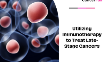 Utilizing Immunotherapy to Treat Late-Stage Cancers