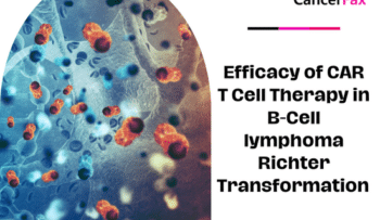 Efficacy of CAR T Cell Therapy in B-Cell lymphoma Richter Transformation