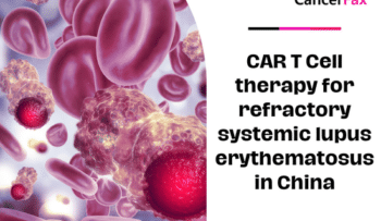 CAR T Cell therapy for refractory systemic lupus erythematosus in China