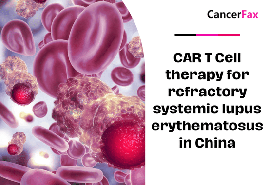 CAR T Cell therapy for refractory systemic lupus erythematosus in China