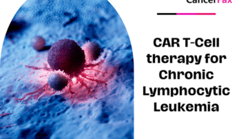 CAR T-Cell therapy for Chronic Lymphocytic Leukemia