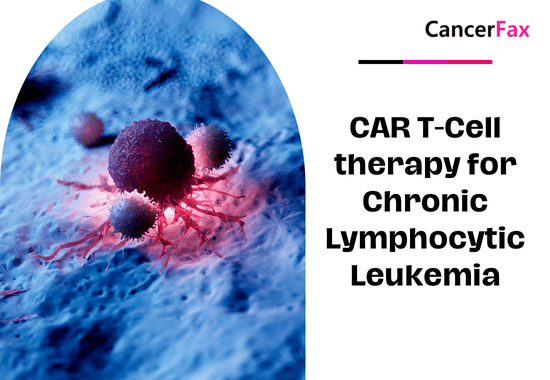 CAR T-Cell therapy for Chronic Lymphocytic Leukemia