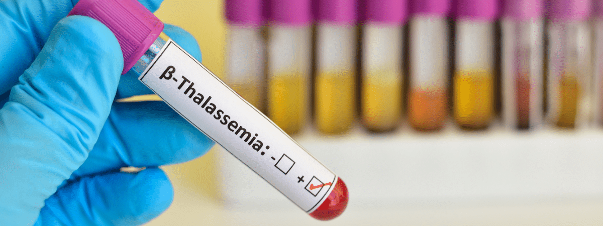 beta thalassemia