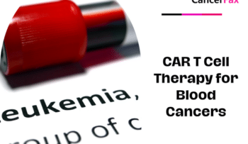 CAR T Cell Therapy for Blood Cancers