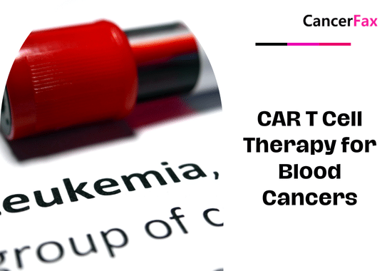 CAR T Cell Therapy for Blood Cancers