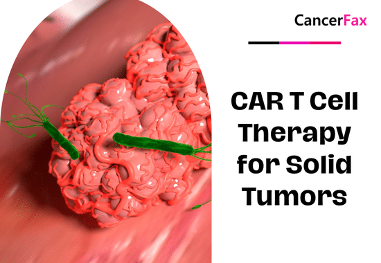 CAR T Cell Therapy for Solid Tumors