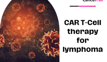 CAR T-Cell therapy for lymphoma