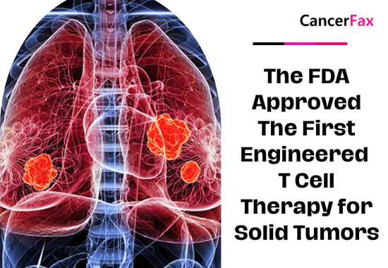 The FDA Approved The First Engineered T Cell Therapy for Solid Tumors