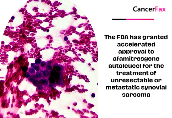 The FDA has granted accelerated approval to afamitresgene autoleucel for the treatment of unresectable or metastatic synovial sarcoma