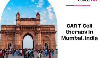 CAR T Cell therapy in Mumbai, India