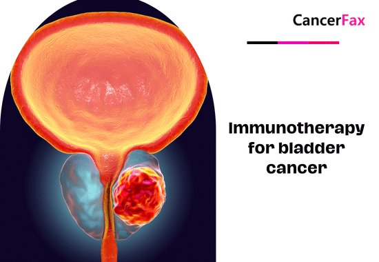 Immunotherapy for bladder cancer