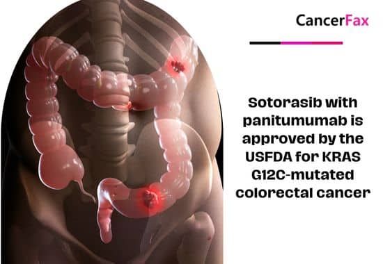 Sotorasib with panitumumab is approved by the USFDA for KRAS G12C-mutated colorectal cancer