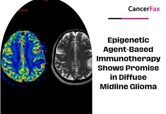Epigenetic Agent-Based Immunotherapy Shows Promise in Diffuse Midline Glioma